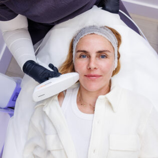 Skin Resurfacing Package of 4 Treatments – 50% Off